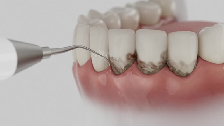 Trusted Invisalign Clear Aligners service in Belmont, VA - Dentist Open Now
